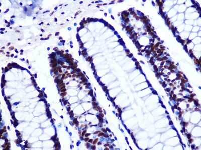 Immunohistochemistry-Paraffin: GTPBP4 Antibody (7O5L6) [NBP3-16476] - Immunohistochemistry of paraffin-embedded human colon using GTPBP4 Rabbit mAb (NBP3-16476) at dilution of 1:100 (40x lens).Perform microwave antigen retrieval with 10 mM PBS buffer pH 7.2 before commencing with IHC staining protocol.