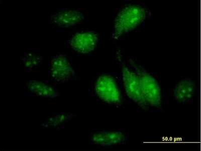 Immunocytochemistry/Immunofluorescence: GTPBP4 Antibody [H00023560-B01P] - Analysis of purified antibody to GTPBP4 on HeLa cell. (antibody concentration 10 ug/ml)