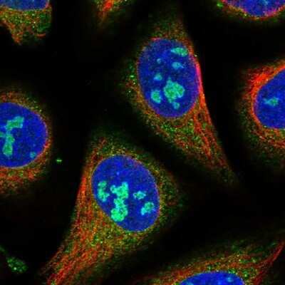 Immunocytochemistry/Immunofluorescence: GTPBP4 Antibody [NBP1-85454] - Staining of human cell line U-2 OS shows positivity in nucleoli, nuclear membrane and cytoplasm.