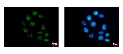 Immunocytochemistry/Immunofluorescence: GTPBP4 Antibody [NBP2-16766] - A431 cells were fixed in iced-cold MeOH for 5 min. Green: GTPBP4 protein stained by GTPBP4 antibody diluted at 1:500. Blue: Hoechst 33343 staining.