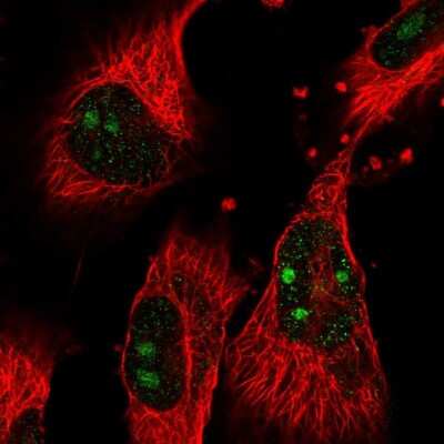 Immunocytochemistry/Immunofluorescence: GTPBP4 Antibody [NBP2-58477] - Staining of human cell line U-251 MG shows localization to nucleoli.