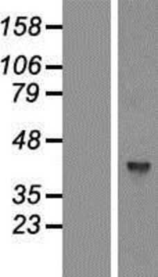 Western Blot GTPBP5 Overexpression Lysate
