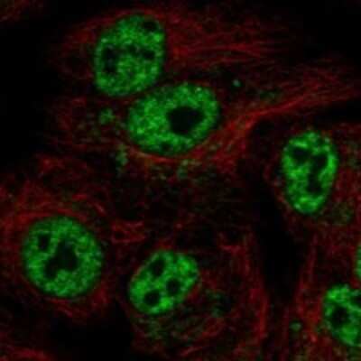 Immunocytochemistry/Immunofluorescence: GTPBP6 Antibody [NBP3-17590] - Staining of human cell line A549 shows localization to nucleoplasm & mitochondria.