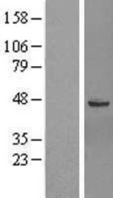 Western Blot: GTPBP6 Overexpression Lysate (Adult Normal) [NBL1-11402] Left-Empty vector transfected control cell lysate (HEK293 cell lysate); Right -Over-expression Lysate for GTPBP6.