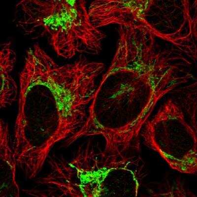 Immunocytochemistry/ Immunofluorescence GTPBP8 Antibody - BSA Free