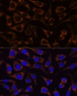 Immunocytochemistry/Immunofluorescence: GTPBP8 Antibody [NBP3-04469] - Analysis of L929 cells using GTPBP8 antibody at dilution of 1:100. Blue: DAPI for nuclear staining.