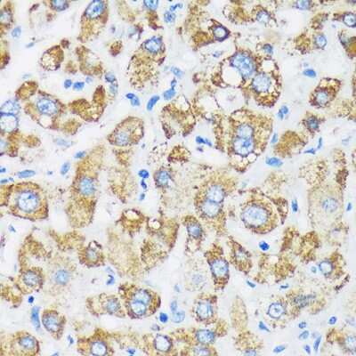 Immunohistochemistry-Paraffin: GTPBP8 Antibody [NBP3-04469] - Immunohistochemistry of paraffin-embedded Human liver using GTPBP8 Rabbit pAb (NBP3-04469) at dilution of 1:100 (40x lens). Perform microwave antigen retrieval with 10 mM PBS buffer pH 7.2 before commencing with IHC staining protocol.