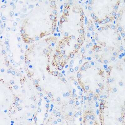 Immunohistochemistry-Paraffin: GTPBP8 Antibody [NBP3-04469] - Immunohistochemistry of paraffin-embedded Rat kidney using GTPBP8 Rabbit pAb (NBP3-04469) at dilution of 1:100 (40x lens). Perform microwave antigen retrieval with 10 mM PBS buffer pH 7.2 before commencing with IHC staining protocol.