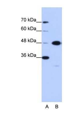 Western Blot: GTPBP9 Antibody [NBP1-57545] - Jurkat cell lysate, Antibody Titration: 0.2-1 ug/ml