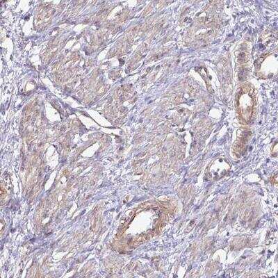 Immunohistochemistry-Paraffin: GTSE1 Antibody [NBP2-32552] - Staining of human smooth muscle shows moderate cytoplasmic positivity in smooth muscle cells.