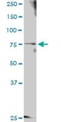 Western Blot GTSE1 Antibody - Azide and BSA Free
