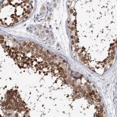 Immunohistochemistry-Paraffin GTSF1 Antibody - BSA Free