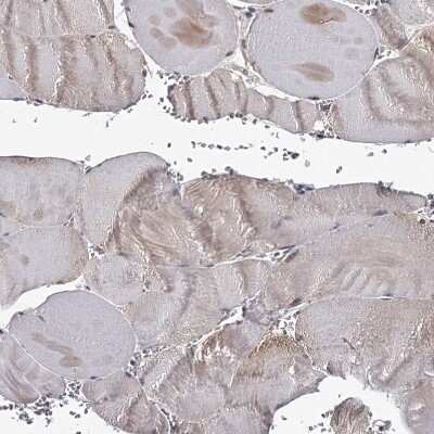 Immunohistochemistry-Paraffin GTSF1 Antibody - BSA Free