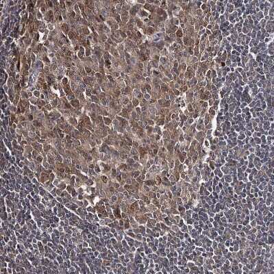 Immunohistochemistry-Paraffin GTSF1 Antibody - BSA Free