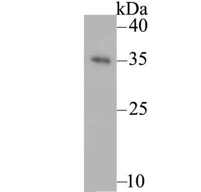 Western Blot: GTSF1 Antibody [NBP2-76934] - Western blot analysis of GTSF1 on zebrafish lysate. Proteins were transferred to a PVDF membrane and blocked with 5% BSA in PBS for 1 hour at room temperature. The primary antibody was used at a 1:200 dilution in 5% BSA at room temperature for 2 hours. Goat Anti-Rabbit IgG - HRP Secondary Antibody at 1:5,000 dilution was used for 1 hour at room temperature.