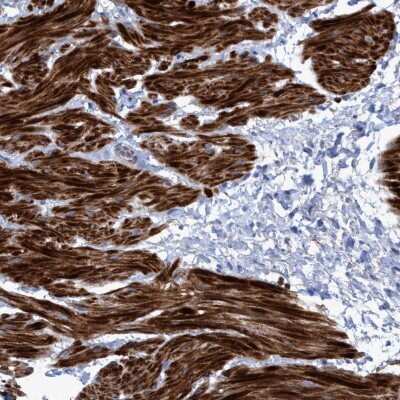 Immunohistochemistry-Paraffin GULP1/CED-6 Antibody