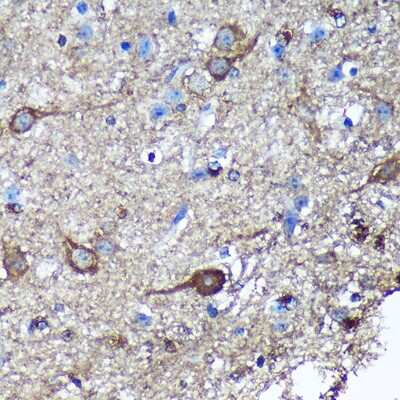 Immunohistochemistry-Paraffin: GULP1/CED-6 Antibody [NBP3-03258] - Immunohistochemistry of paraffin-embedded Mouse spinal cord using GULP1/CED-6 Rabbit pAb (NBP3-03258) at dilution of 1:100 (40x lens). Perform microwave antigen retrieval with 10 mM PBS buffer pH 7.2 before commencing with IHC staining protocol.