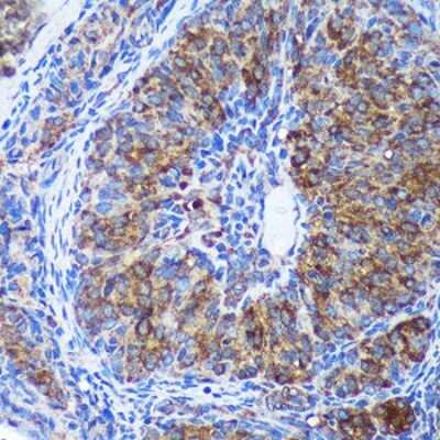 Immunohistochemistry-Paraffin: GULP1/CED-6 Antibody [NBP3-03258] - Immunohistochemistry of paraffin-embedded Rat ovary using GULP1/CED-6 Rabbit pAb (NBP3-03258) at dilution of 1:100 (40x lens). Perform microwave antigen retrieval with 10 mM PBS buffer pH 7.2 before commencing with IHC staining protocol.