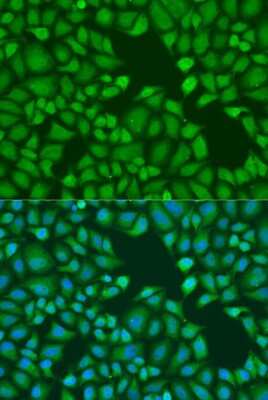 Immunocytochemistry/Immunofluorescence: GW182 Antibody [NBP3-03014] - Analysis of U2OS cells using GW182 antibody at dilution of 1:100. Blue: DAPI for nuclear staining.
