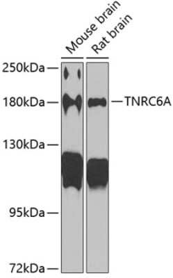 Western Blot: GW182 Antibody [NBP3-03014] - Analysis of extracts of various cell lines, using GW182 antibody at 1:1000 dilution. Secondary antibody: HRP Goat Anti-Rabbit IgG (H+L) at 1:10000 dilution. Lysates/proteins: 25ug per lane. Blocking buffer: 3% nonfat dry milk in TBST. Detection: ECL Basic Kit