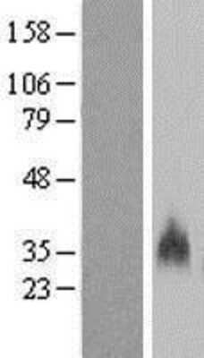 Western Blot: GYPB Overexpression Lysate (Adult Normal) [NBP2-08148] Left-Empty vector transfected control cell lysate (HEK293 cell lysate); Right -Over-expression Lysate for GYPB.