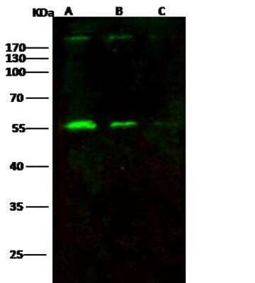 Western Blot Gag polyprotein Antibody