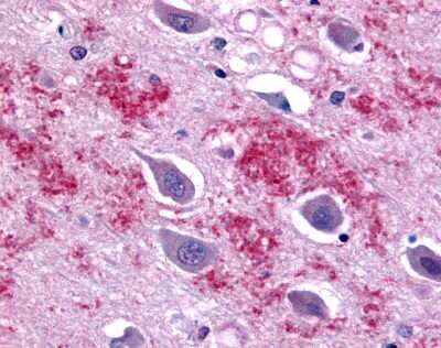 Immunohistochemistry-Paraffin: Galanin R1/GALR1 Antibody [NLS4013] - Analysis of anti-GALR1 antibody with human brain.