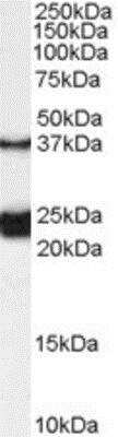 Western Blot: Galanin R1/GALR1 Antibody [NB100-57080] -  (0.1ug/ml) staining of Rat Spinal Cord lysate (35ug protein in RIPA buffer). Primary incubation was 1 hour. Detected by chemiluminescence.