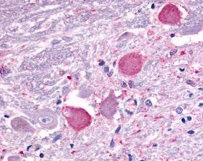 Immunohistochemistry-Paraffin: Galanin R2/GALR2 Antibody [NLS4155] - Analysis of anti-GALR2 antibody with human brain, neurons and glia.