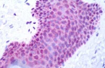 Immunohistochemistry-Paraffin: Galanin R2/GALR2 Antibody [NLS4155] - Human Skin: Formalin-Fixed, Paraffin-Embedded (FFPE)