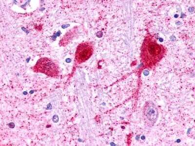 Immunohistochemistry-Paraffin: Galanin R3/GALR3 Antibody [NLS204] - Analysis of anti-GALR3 antibody with human brain, neurons and glia at 11 ug/ ml.