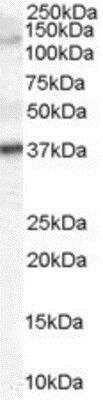 Western Blot: Galanin R3/GALR3 Antibody [NB100-2846] - (2ug/ml) Human Skin lysate (35ug protein in RIPA buffer). Primary incubation was 1 hour. Detected by chemiluminescence.