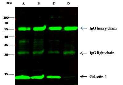 Immunoprecipitation: Galectin-1 Antibody (001) [NBP2-89387] - Lane A:0.5 mg Hela Whole Cell Lysate Lane B:0.5 mg K562 Whole Cell LysateLane C:0.5 mg A431 Whole Cell Lysate Lane D:0.5 mg HL-60 Whole Cell Lysate2 uL anti-Galectin1 rabbit monoclonal antibody and 15 ul of 50 % Protein G agarose. Primary antibody: Anti-Galectin1 rabbit monoclonal antibody,at 1:100 dilution Secondary antibody: Dylight 800-labeled antibody to rabbit IgG (H+L), at 1:5000 dilution Developed using the odssey technique. Performed under reducing conditions. Predicted band size: 15 kDa Observed band size: 15 kDa