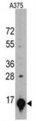 Western Blot: Galectin-1 Antibody (24CT661.4.3) [NBP2-11500] - Western blot analysis of GLT Monoclonal Antibody in A375 cell line lysates.