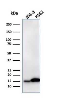 Western Blot: Galectin-1 Antibody (GAL1/2499R) [NBP2-79721] - Western Blot Analysis of JEG-3 and K562 cell lysate using Galectin-1 antibody (GAL1/2499R).