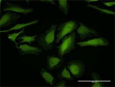 Immunocytochemistry/Immunofluorescence: Galectin-1 Antibody [H00003956-D01P] - Analysis of antibody to LGALS1 on HeLa cell. Antibody concentration 10 ug/ml.