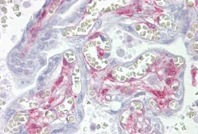 Immunohistochemistry-Paraffin: Galectin-1 Antibody [NBP1-59002] - Galectin 1 Antibody [NBP1-59002] - Human placenta tissue at an antibody concentration of 5ug/ml.