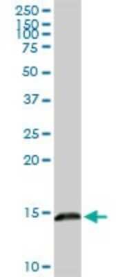 Western Blot: Galectin-1 Antibody [H00003956-D01P] - Analysis of LGALS1 expression in human kidney.