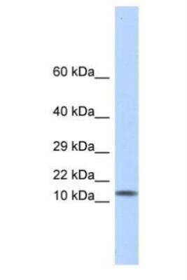 Western Blot: Galectin-1 Antibody [NBP1-59002] -  Titration: 0.2-1 ug/ml, Positive Control: Human Muscle.