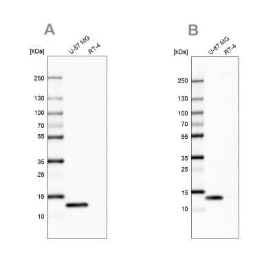 Western Blot: Galectin-1 Antibody [NBP2-76490] - Analysis using Anti-LGALS1 antibody NBP2-76490 (A) shows similar pattern to independent antibody NBP1-89791(B).