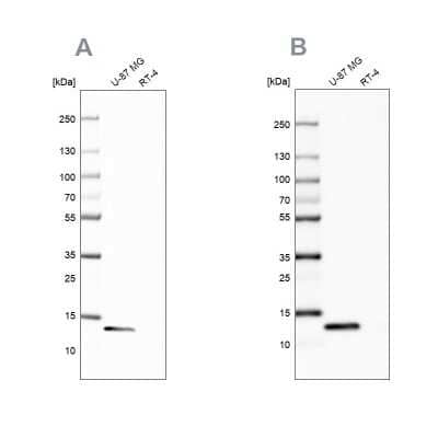 Western Blot: Galectin-1 Antibody [NBP2-76499] - Analysis using Anti-LGALS1 antibody NBP2-76499130 (A) shows similar pattern to independent antibody NBP2-76490 (B).