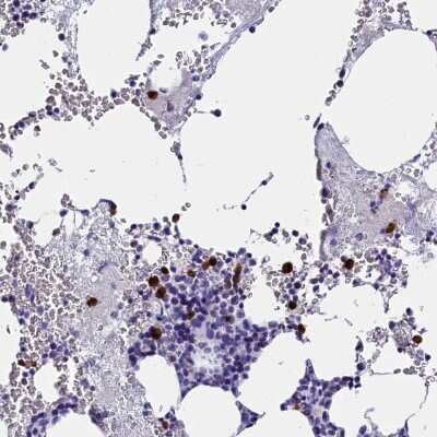 Immunohistochemistry-Paraffin: Galectin-10 Antibody [NBP1-87688] - Staining of human bone marrow shows high expression.