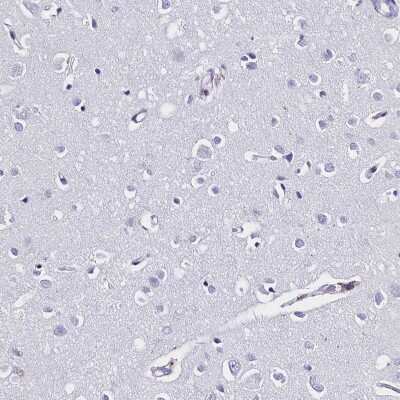 Immunohistochemistry-Paraffin: Galectin-10 Antibody [NBP1-87688] - Staining of human cerebral cortex shows low expression as expected.