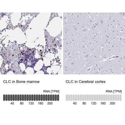 Immunohistochemistry-Paraffin Galectin-10 Antibody