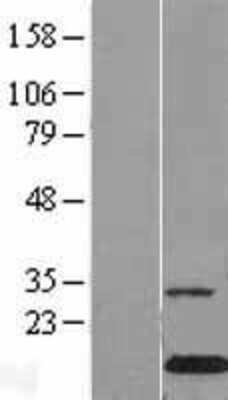 Western Blot Galectin-10 Overexpression Lysate