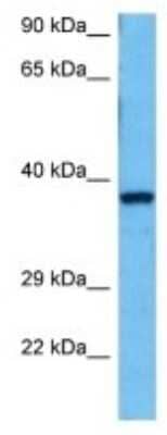 Western Blot: Galectin-12 Antibody [NBP3-10172] - Western blot analysis of Galectin-12 in Mouse Kidney lysates. Antibody dilution at 1ug/ml