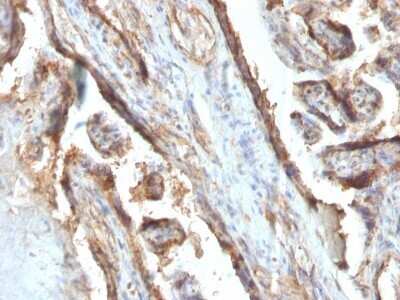 Immunohistochemistry-Paraffin: Galectin 13 Antibody (PP13/1161) - Azide and BSA Free [NBP2-54358] - Formalin-paraffin human Placenta stained with Galectin-13 MAb (PP13/1161).