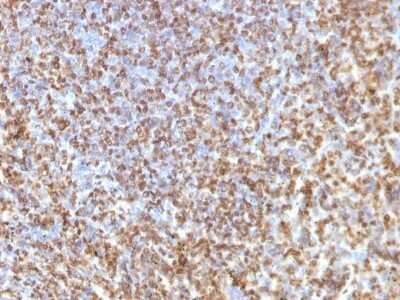Immunohistochemistry-Paraffin: Galectin 13 Antibody (PP13/1161) - Azide and BSA Free [NBP2-54358] - Formalin-paraffin human Spleen stained with Galectin-13MAb (PP13/1161).