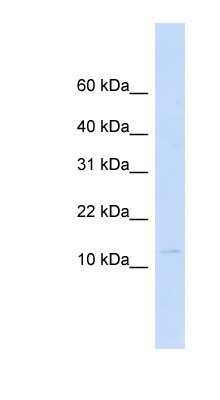 Western Blot: Galectin 13 Antibody [NBP1-80504] - Titration: 0.2-1 ug/ml, Positive Control: Human heart.