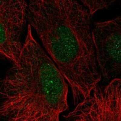 Immunocytochemistry/Immunofluorescence: Galectin-14/LGALS14 Antibody [NBP3-17493] - Staining of human cell line U-2 OS shows localization to nucleoplasm.